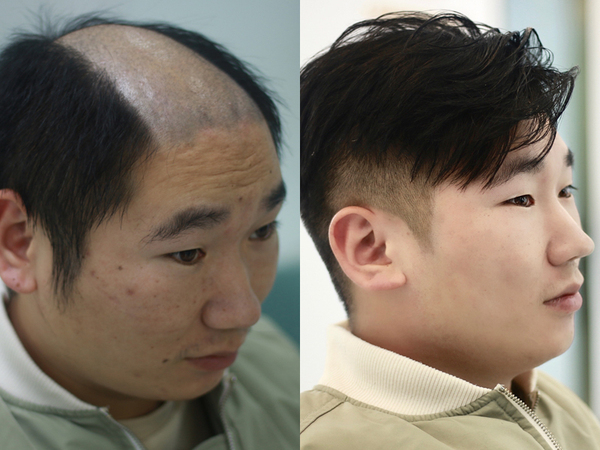 男士假发