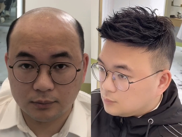 男士假发